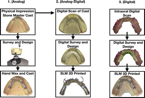 fabrication process of a cast metal partial denture ppt|removable partial denture steps.